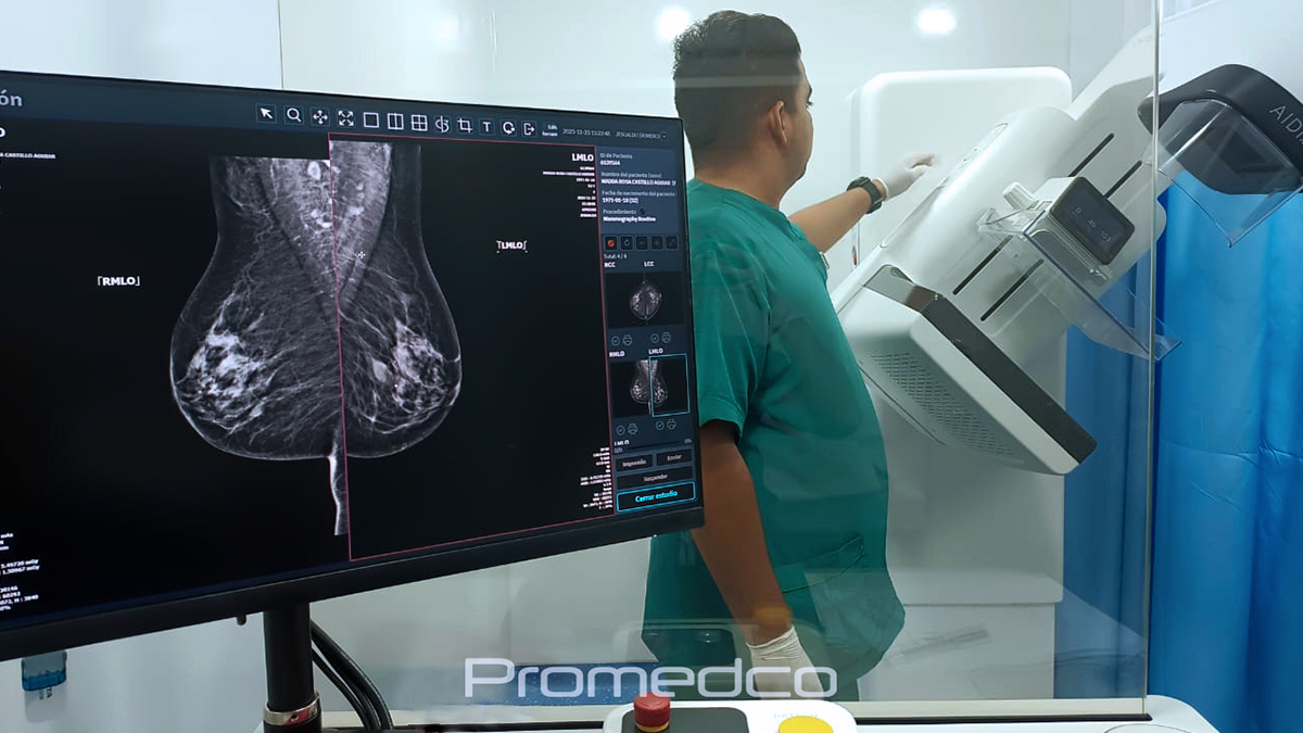 Representación proceso de mamografía